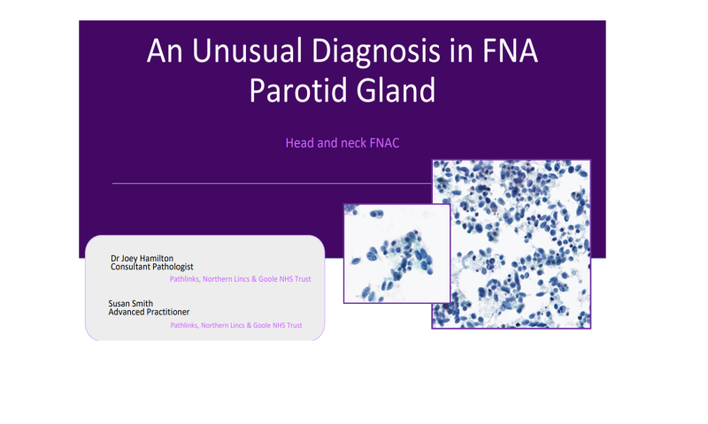 March Case Study - An unusual diagnosis in FNA parotid gland