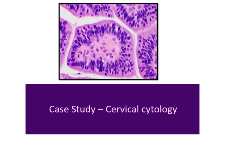 November Case Study -  Cervical Cytology