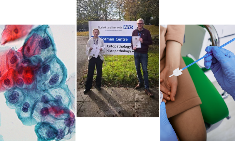 November Blog: Exam Success: IBMS Advanced Specialist Diploma (ASD) in Cervical Cytology