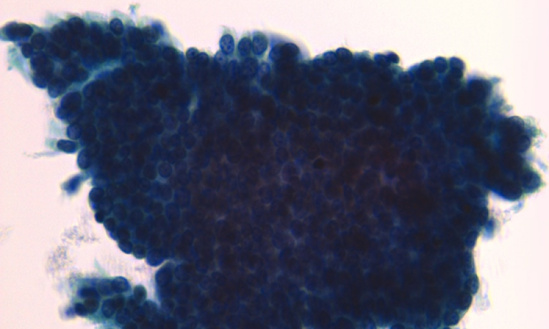 September Case Study - Cervical Cytology